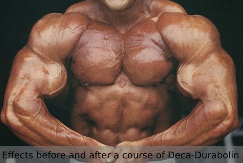 Effects before and after a course of Deca-Durabolin